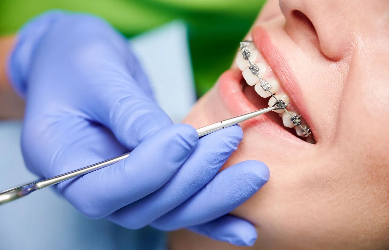 Visita ortodontica presso Studio Smile