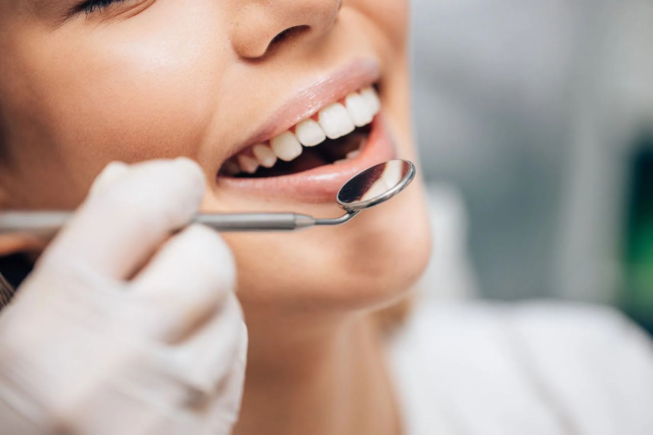 Paziente in trattamento con faccette dentali