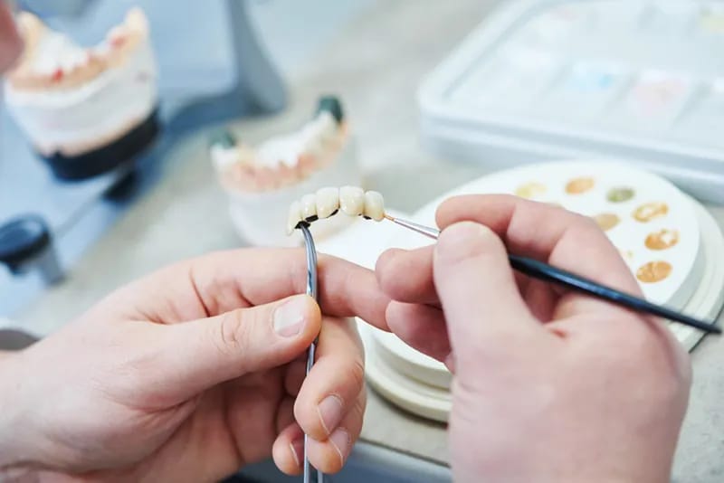 Preparazione per procedura implantare